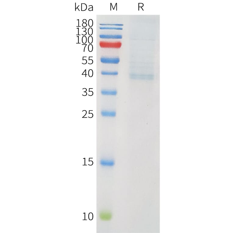 SDS-PAGE - Recombinant Human PVRIG Protein (C-terminal hFc Tag) (A332908) - Antibodies.com