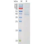 SDS-PAGE - Recombinant Human PVRIG Protein (C-terminal hFc Tag) (A332908) - Antibodies.com