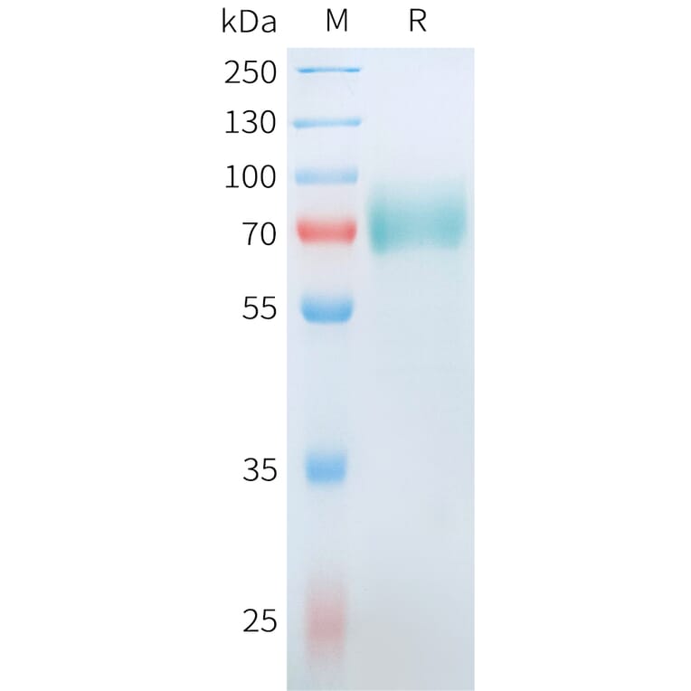 SDS-PAGE - Recombinant Human CD19 Protein (C-terminal hFc Tag) (A332910) - Antibodies.com
