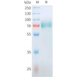 SDS-PAGE - Recombinant Human CD19 Protein (C-terminal hFc Tag) (A332910) - Antibodies.com
