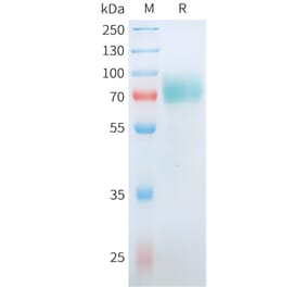 SDS-PAGE - Recombinant Human CD19 Protein (C-terminal hFc Tag) (A332911) - Antibodies.com