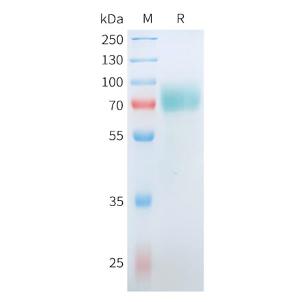 SDS-PAGE - Recombinant Human CD19 Protein (C-terminal hFc Tag) (A332911) - Antibodies.com