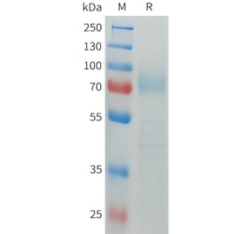SDS-PAGE - Recombinant Human CD64 Protein (C-terminal hFc Tag) (A332913) - Antibodies.com