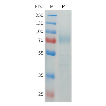 SDS-PAGE - Recombinant Human CD64 Protein (C-terminal hFc Tag) (A332913) - Antibodies.com