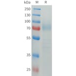 SDS-PAGE - Recombinant Human CD64 Protein (C-terminal hFc Tag) (A332913) - Antibodies.com