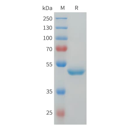 SDS-PAGE - Recombinant Human G-CSF Protein (C-terminal hFc Tag) (A332914) - Antibodies.com
