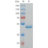 SDS-PAGE - Recombinant Human G-CSF Protein (C-terminal hFc Tag) (A332914) - Antibodies.com