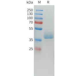 SDS-PAGE - Recombinant Human LI Cadherin Protein (C-terminal hFc Tag) (A332915) - Antibodies.com