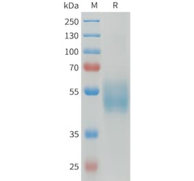 SDS-PAGE - Recombinant Human CD64 Protein (C-terminal 6xHis Tag) (A332921) - Antibodies.com