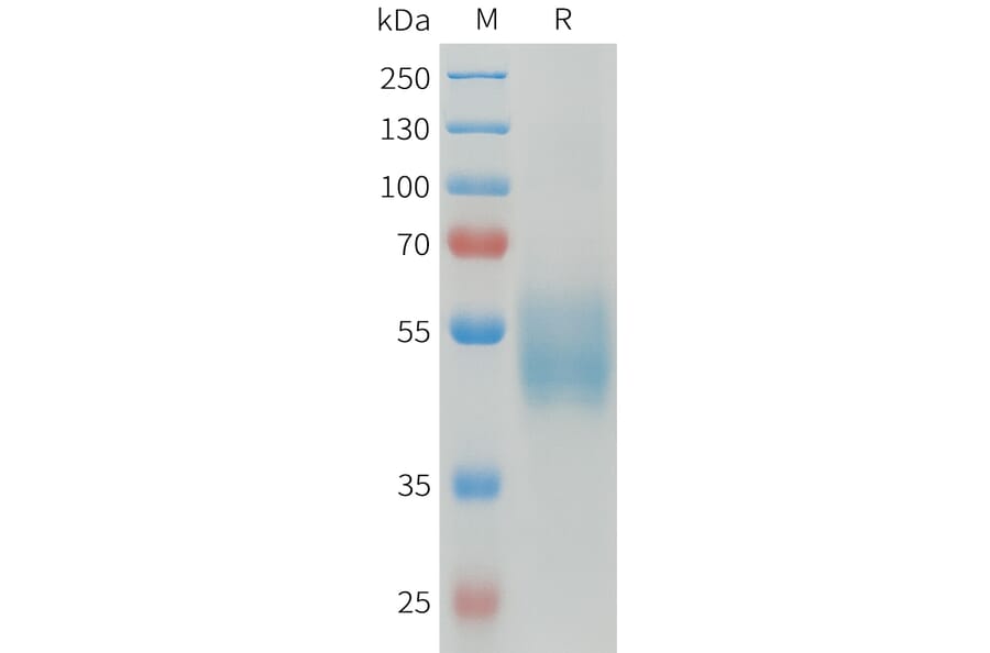 SDS-PAGE - Recombinant Human CD64 Protein (C-terminal 6xHis Tag) (A332921) - Antibodies.com