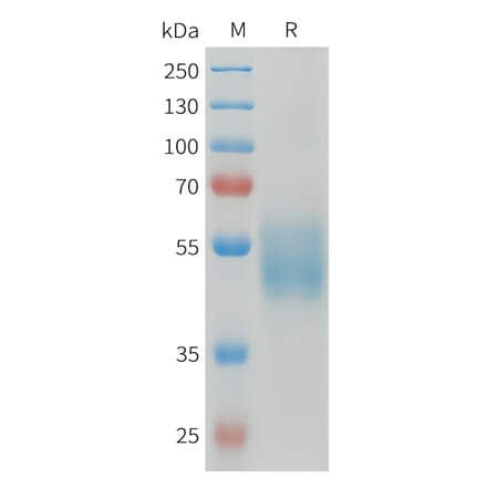 SDS-PAGE - Recombinant Human CD64 Protein (C-terminal 6xHis Tag) (A332921) - Antibodies.com
