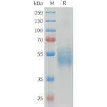 SDS-PAGE - Recombinant Human CD64 Protein (C-terminal 6xHis Tag) (A332921) - Antibodies.com