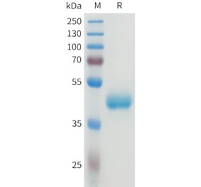 SDS-PAGE - Recombinant Human CEA Protein (C-terminal hFc Tag) (A332922) - Antibodies.com