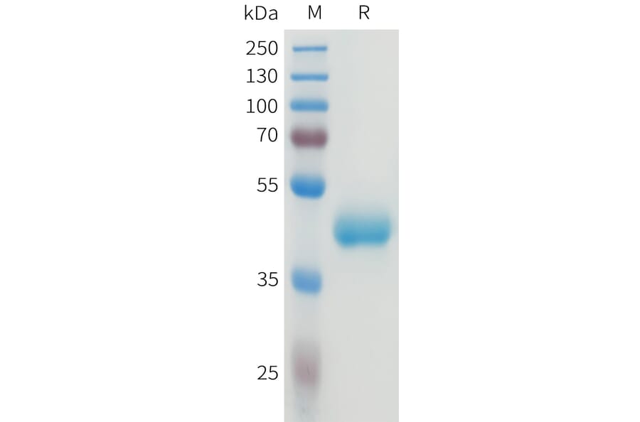 SDS-PAGE - Recombinant Human CEA Protein (C-terminal hFc Tag) (A332922) - Antibodies.com