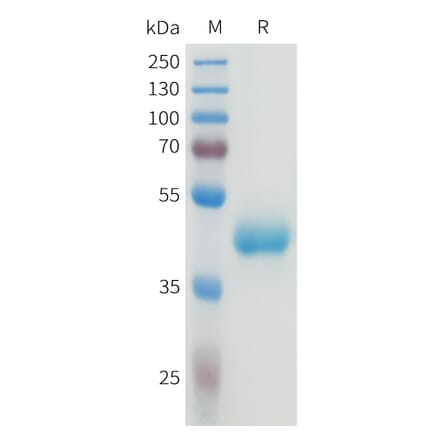 SDS-PAGE - Recombinant Human CEA Protein (C-terminal hFc Tag) (A332922) - Antibodies.com