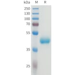 SDS-PAGE - Recombinant Human CEA Protein (C-terminal hFc Tag) (A332922) - Antibodies.com