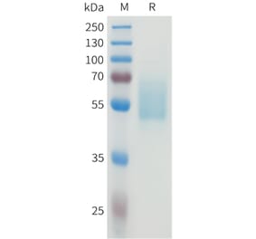 SDS-PAGE - Recombinant Human CEA Protein (C-terminal hFc Tag) (A332923) - Antibodies.com