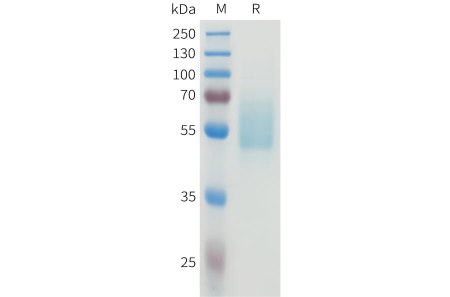 SDS-PAGE - Recombinant Human CEA Protein (C-terminal hFc Tag) (A332923) - Antibodies.com