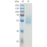 SDS-PAGE - Recombinant Human CEA Protein (C-terminal hFc Tag) (A332923) - Antibodies.com