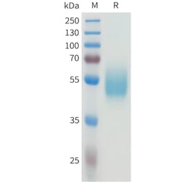 SDS-PAGE - Recombinant Human CEA Protein (C-terminal hFc Tag) (A332924) - Antibodies.com