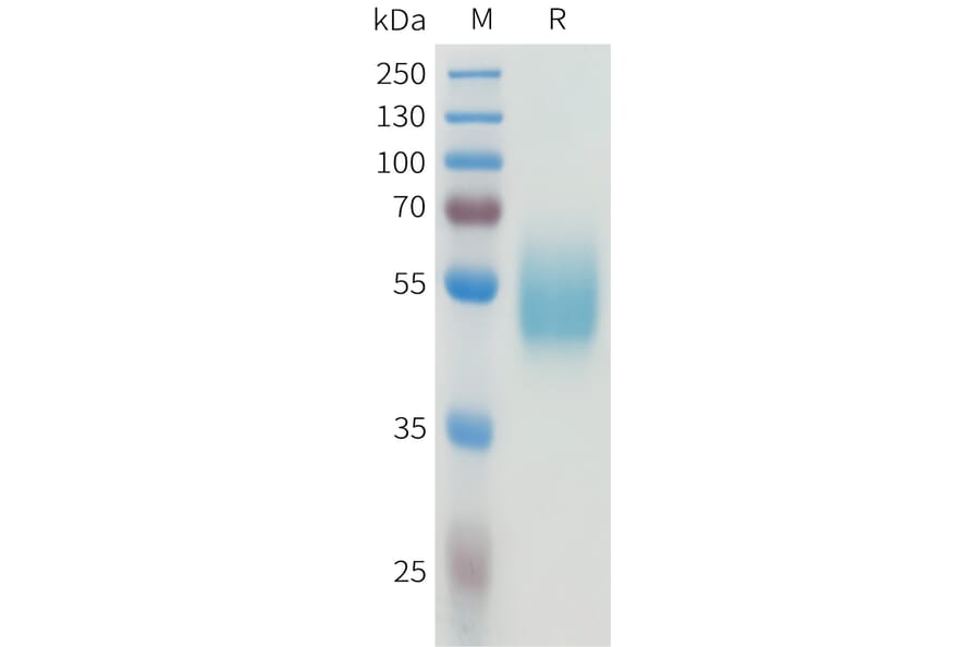 SDS-PAGE - Recombinant Human CEA Protein (C-terminal hFc Tag) (A332924) - Antibodies.com
