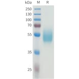SDS-PAGE - Recombinant Human CEA Protein (C-terminal hFc Tag) (A332924) - Antibodies.com