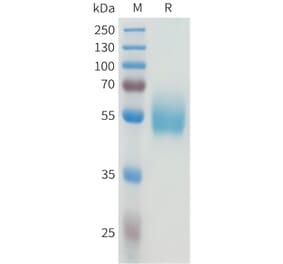 SDS-PAGE - Recombinant Human CEA Protein (C-terminal hFc Tag) (A332925) - Antibodies.com