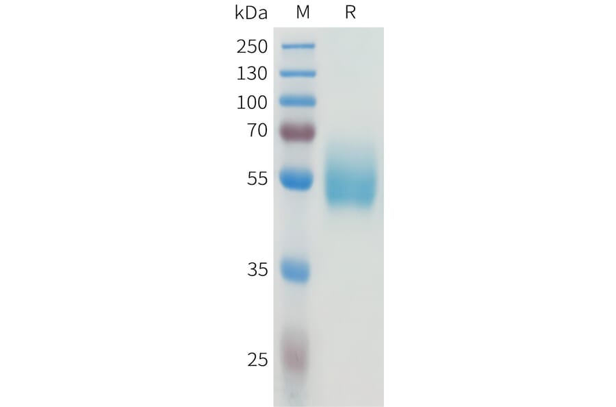 SDS-PAGE - Recombinant Human CEA Protein (C-terminal hFc Tag) (A332925) - Antibodies.com