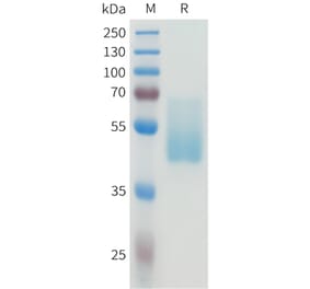 SDS-PAGE - Recombinant Human CEA Protein (C-terminal hFc Tag) (A332926) - Antibodies.com