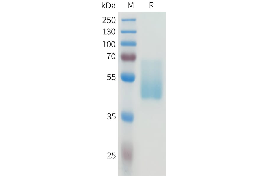 SDS-PAGE - Recombinant Human CEA Protein (C-terminal hFc Tag) (A332926) - Antibodies.com