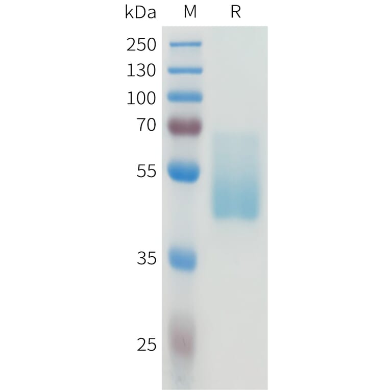 SDS-PAGE - Recombinant Human CEA Protein (C-terminal hFc Tag) (A332926) - Antibodies.com
