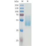 SDS-PAGE - Recombinant Human CEA Protein (C-terminal hFc Tag) (A332926) - Antibodies.com