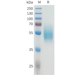 SDS-PAGE - Recombinant Human CEA Protein (C-terminal hFc Tag) (A332927) - Antibodies.com