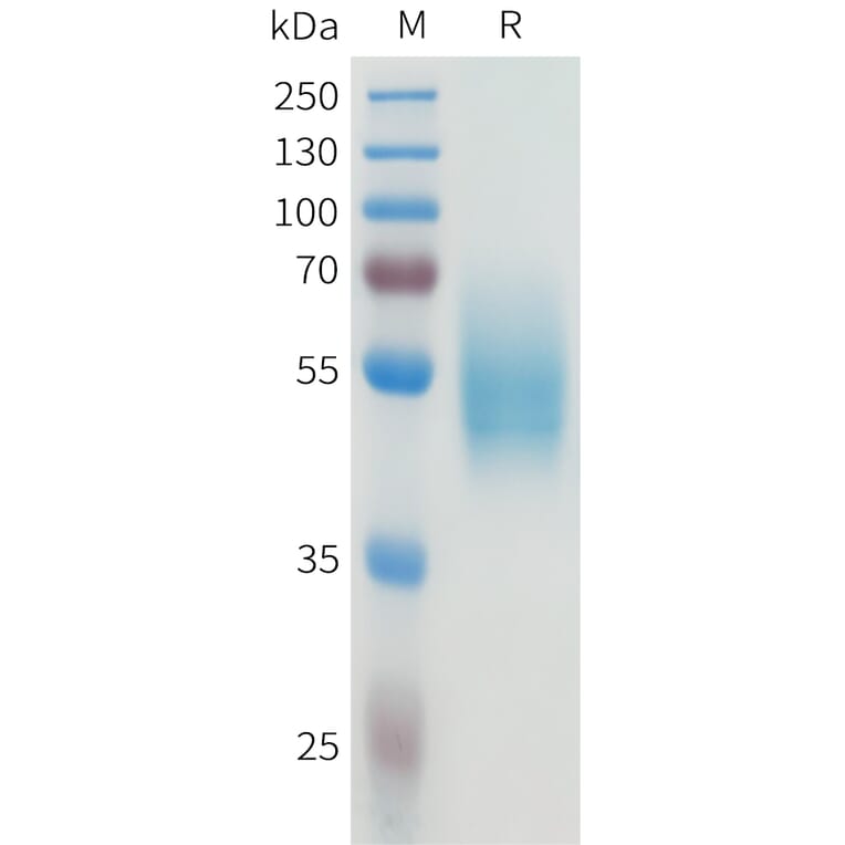 SDS-PAGE - Recombinant Human CEA Protein (C-terminal hFc Tag) (A332927) - Antibodies.com