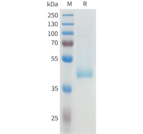 SDS-PAGE - Recombinant Human B7-H4 Protein (C-terminal hFc Tag) (A332928) - Antibodies.com