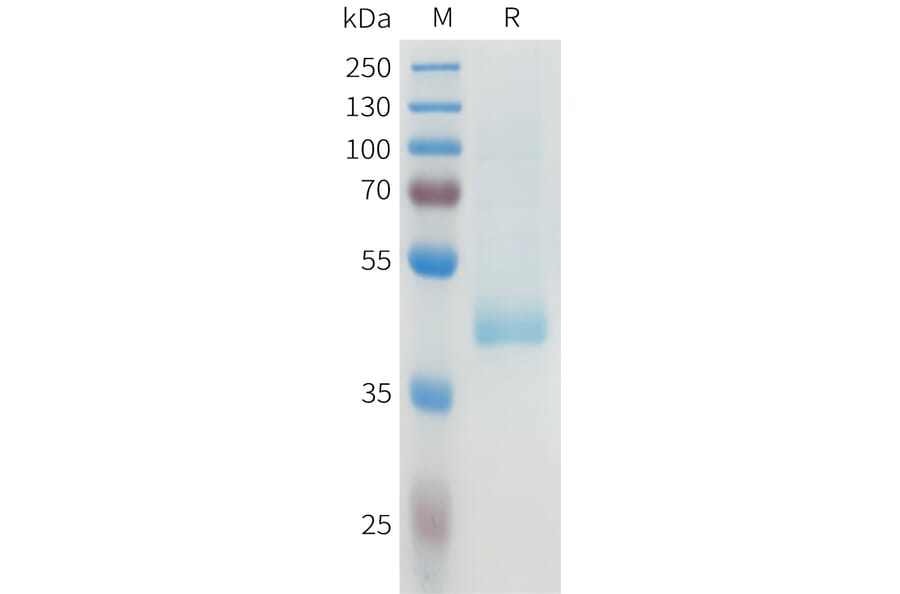 SDS-PAGE - Recombinant Human B7-H4 Protein (C-terminal hFc Tag) (A332928) - Antibodies.com