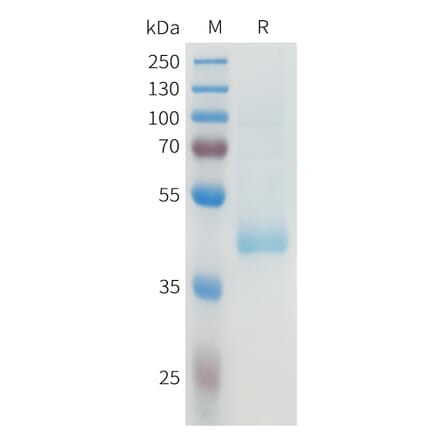 SDS-PAGE - Recombinant Human B7-H4 Protein (C-terminal hFc Tag) (A332928) - Antibodies.com