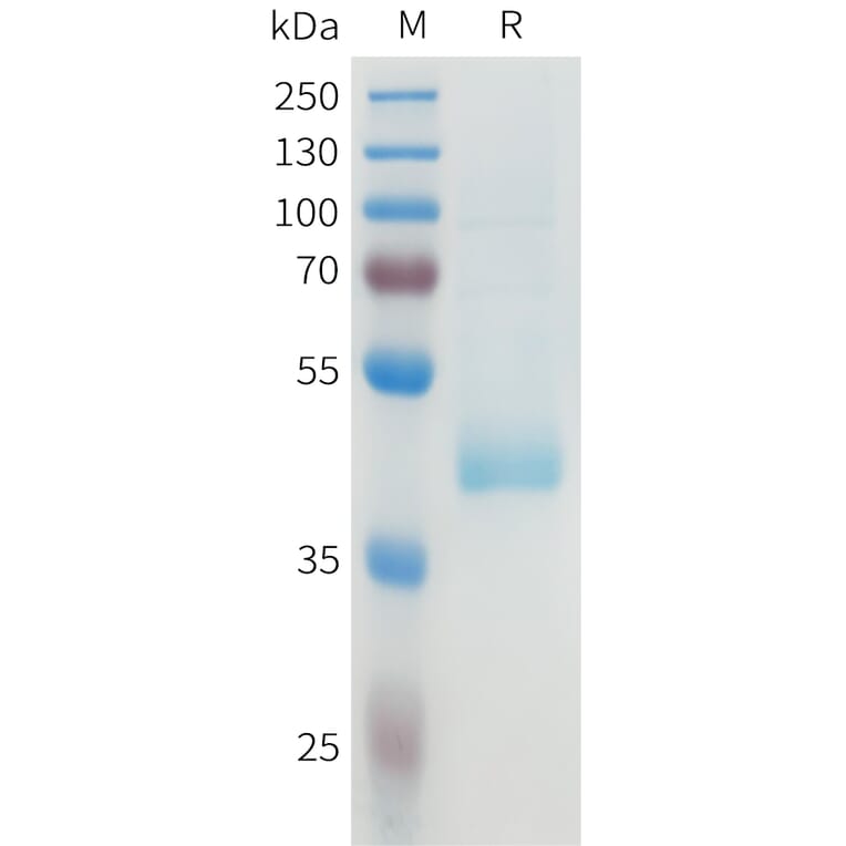 SDS-PAGE - Recombinant Human B7-H4 Protein (C-terminal hFc Tag) (A332928) - Antibodies.com