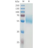 SDS-PAGE - Recombinant Human B7-H4 Protein (C-terminal hFc Tag) (A332929) - Antibodies.com