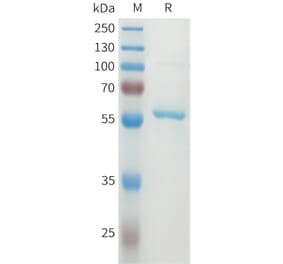 SDS-PAGE - Recombinant Human DLL3 Protein (N-terminal MBP Tag and C-terminal 10xHis Tag) (A332930) - Antibodies.com