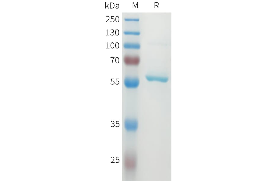 SDS-PAGE - Recombinant Human DLL3 Protein (N-terminal MBP Tag and C-terminal 10xHis Tag) (A332930) - Antibodies.com