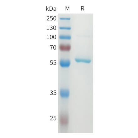 SDS-PAGE - Recombinant Human DLL3 Protein (N-terminal MBP Tag and C-terminal 10xHis Tag) (A332930) - Antibodies.com