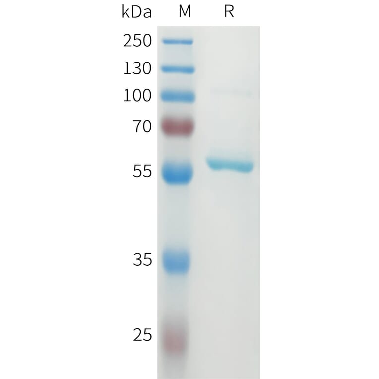 SDS-PAGE - Recombinant Human DLL3 Protein (N-terminal MBP Tag and C-terminal 10xHis Tag) (A332930) - Antibodies.com