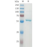 SDS-PAGE - Recombinant Human DLL3 Protein (N-terminal MBP Tag and C-terminal 10xHis Tag) (A332930) - Antibodies.com