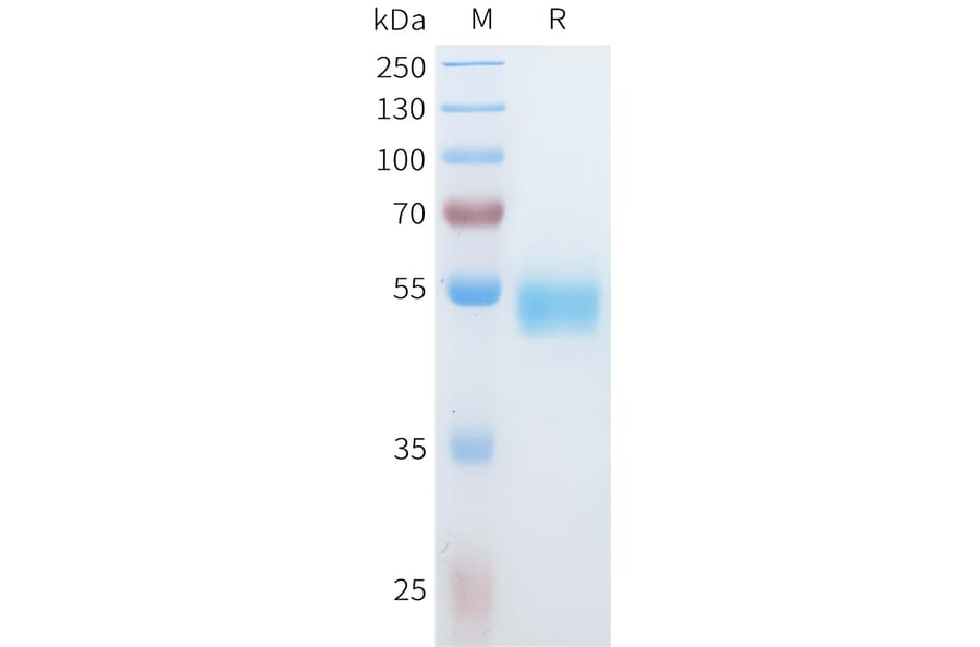 SDS-PAGE - Recombinant Human IL36 alpha/IL-1F6 Protein (C-terminal hFc Tag) (A332931) - Antibodies.com