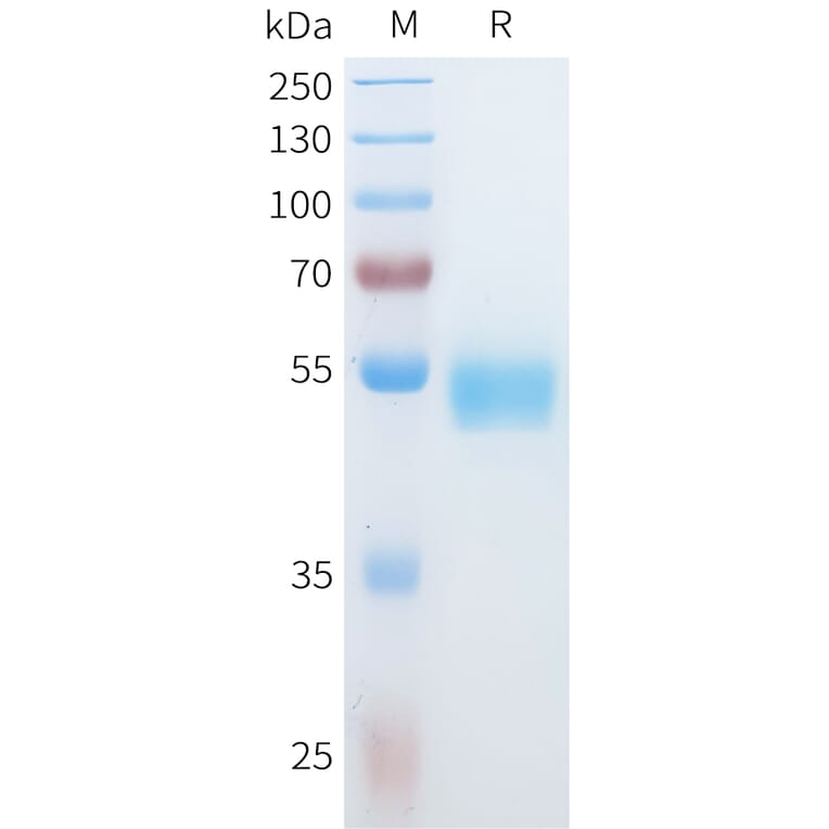 SDS-PAGE - Recombinant Human IL36 alpha/IL-1F6 Protein (C-terminal hFc Tag) (A332931) - Antibodies.com