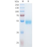 SDS-PAGE - Recombinant Human IL36 alpha/IL-1F6 Protein (C-terminal hFc Tag) (A332931) - Antibodies.com