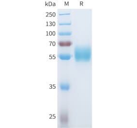 SDS-PAGE - Recombinant Human ROR1 Protein (C-terminal hFc Tag) (A332933) - Antibodies.com
