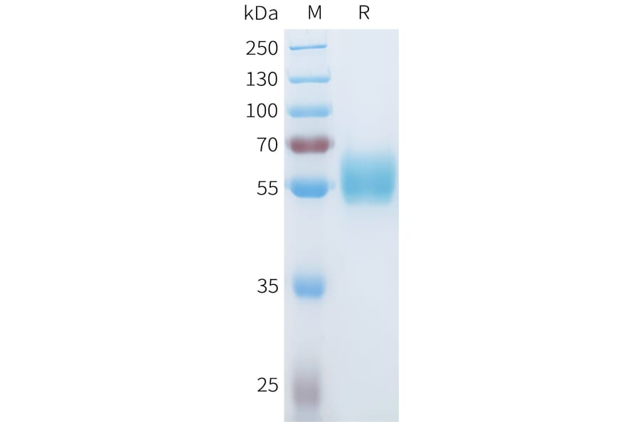 SDS-PAGE - Recombinant Human ROR1 Protein (C-terminal hFc Tag) (A332933) - Antibodies.com