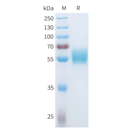 SDS-PAGE - Recombinant Human ROR1 Protein (C-terminal hFc Tag) (A332933) - Antibodies.com
